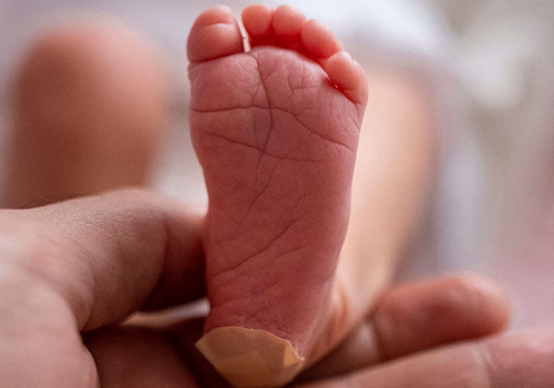 NBS-overview-header The Newborn Screening and Genetics Focus Area at APHL
